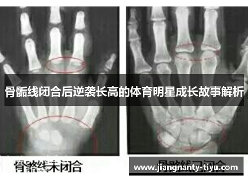 骨骺线闭合后逆袭长高的体育明星成长故事解析